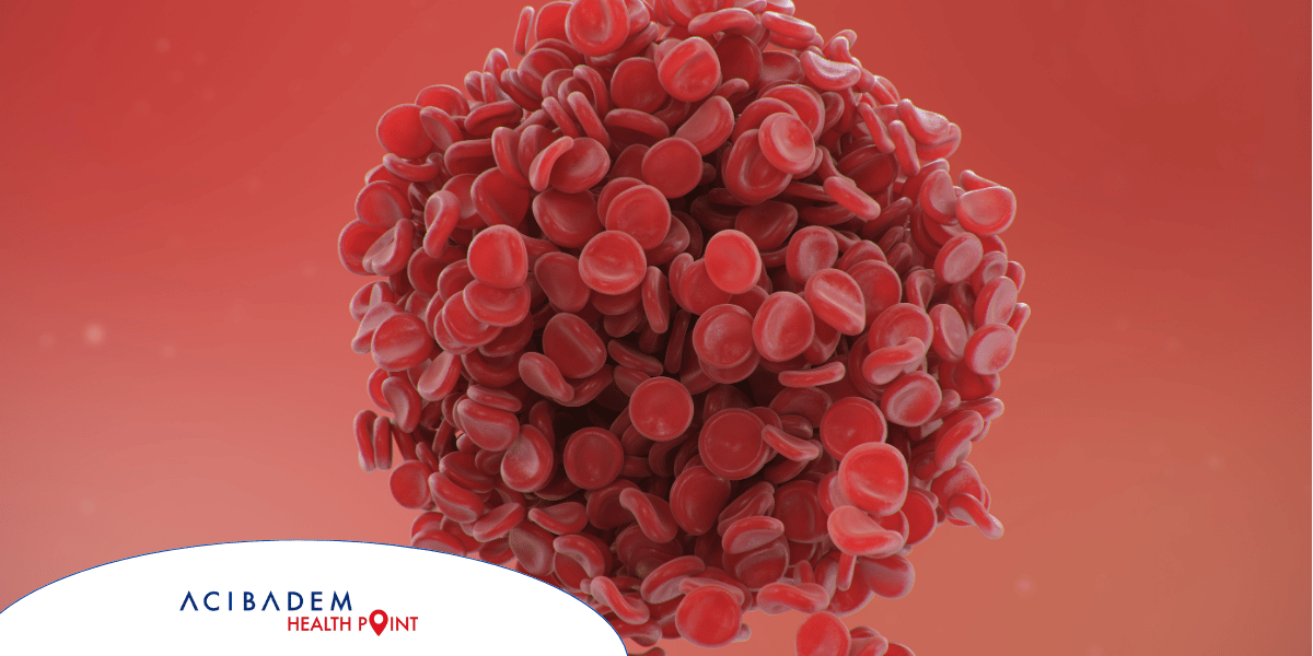 Abdominal Aortic Aneurysm