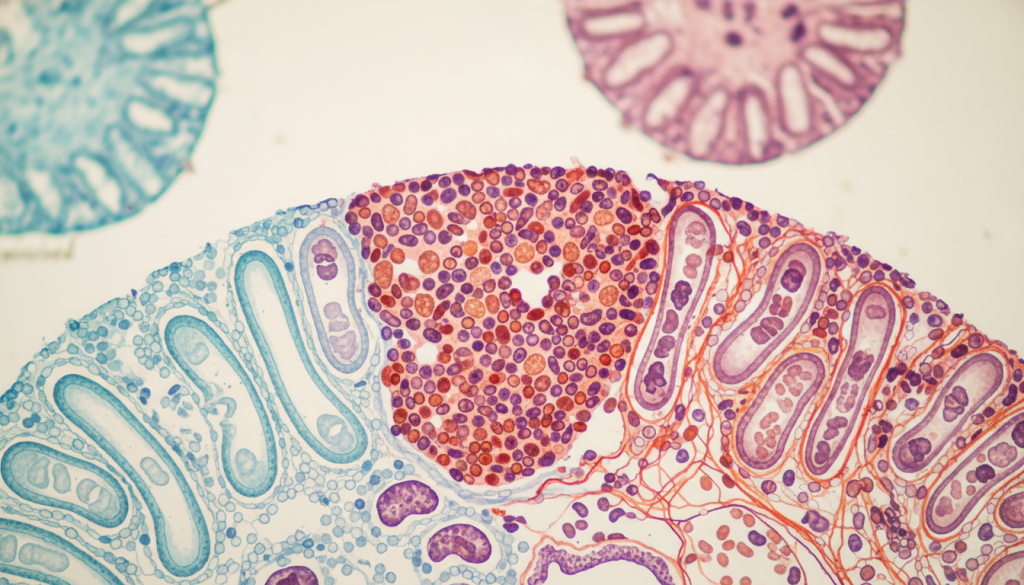 Tubulointerstitial Diseases Tubulointerstitial Diseases